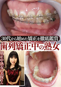 【グリップAV】30代から始めた矯正を徹底鑑賞！歯列矯正中の熟女 【GRAV-387】
