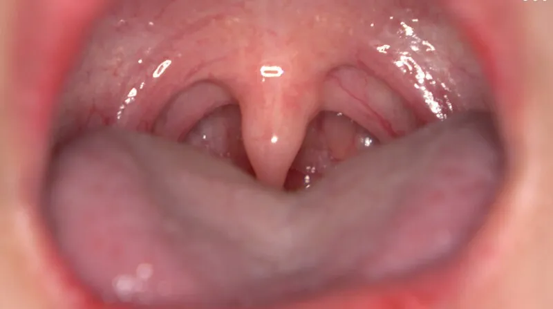 相楽さゆな：新人女神の口元に釘付け！美少女の魅力を高画質で徹底観察 相楽さゆな