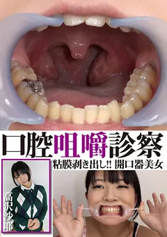 【グリップAV】口腔咀嚼診察 粘膜剥き出し！！開口器美女 高沢沙耶 【GRAV-024】 高沢沙耶